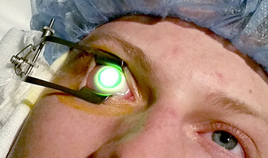Corneal Crosslinking Patient Having Eye illuminated