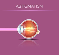 Astigmatism