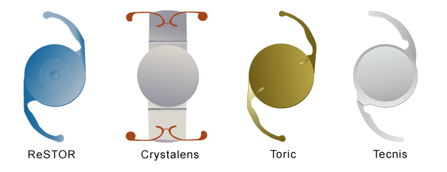 Chart Showing Various IOLs